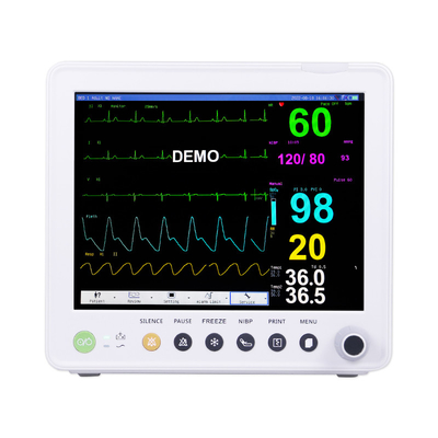 ETCO2 ECG NIBP SPO2 RESP TEMP PR के पैरामीटर के साथ पोर्टेबल रोगी मॉनिटर