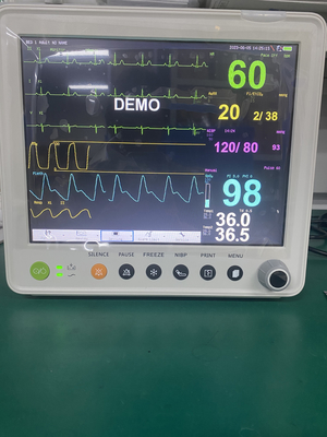 ETCO2 ECG NIBP SPO2 RESP TEMP PR के पैरामीटर के साथ पोर्टेबल रोगी मॉनिटर