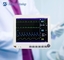 विश्वसनीय मल्टी पैरामीटर रोगी मॉनिटर PM-9000 15 इंच वैकल्पिक मोबाइल कार्ट